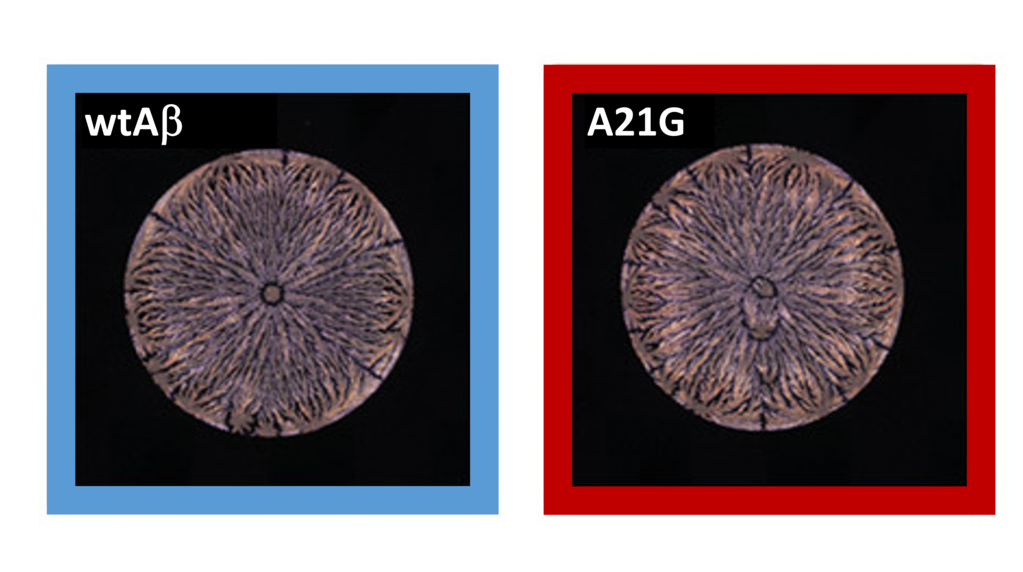 IFG_News_2022_069_Biochemie "Fingerabdruck" von Peptiden erlaubt frueheren Alzheimer_Nachweis