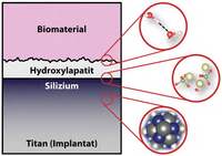 News_Thissen_2016_Prothesen_und_Implantate