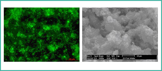 Biofilm_ESEM